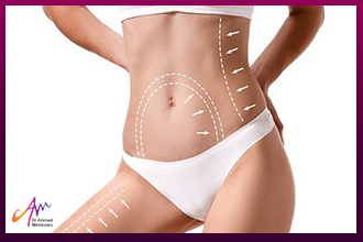 The Difference between Laser Liposuction and VASER Liposuction and Their Characteristics