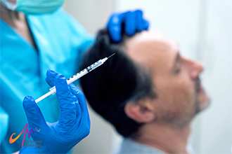زراعة الشعر بالخلايا الجذعية