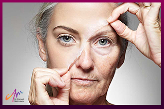 Treatment of facial wrinkles with different techniques and how to prevent wrinkles