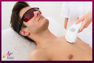 Is Laser Hair Removal for Men the Ideal Technique?