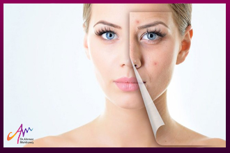 Different Methods for Laser Skin Treatment