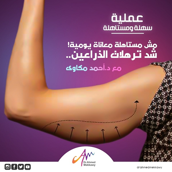 شد ترهلات الذراعين