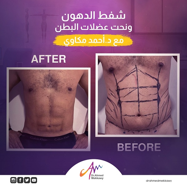 قبل وبعد ال6 باكس