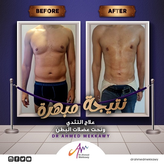 التثدي قبل وب