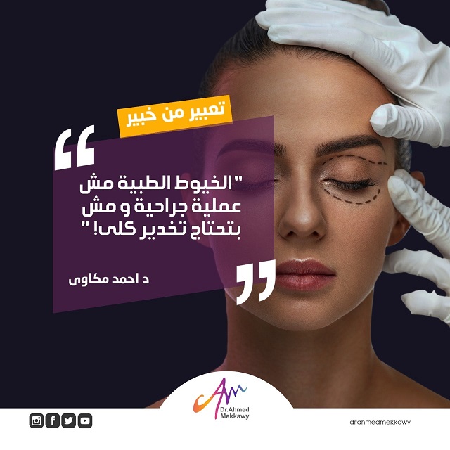 خيوط تجميلية