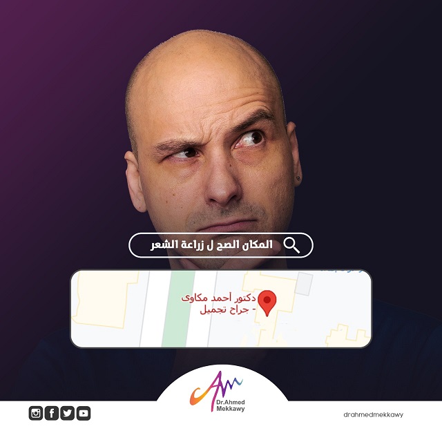 زراعة الشعر