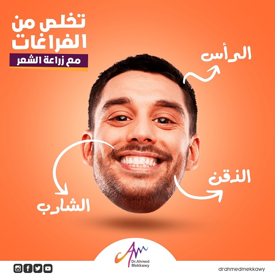 زراعة الشارب